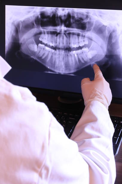 Best Emergency Dental Care for Broken or Chipped Teeth in Mount Vernon, TX