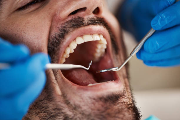 Best Emergency TMJ Treatment in Mount Vernon, TX
